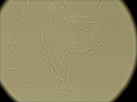 Baktériumok 12
