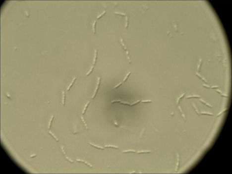 Baktériumok 13