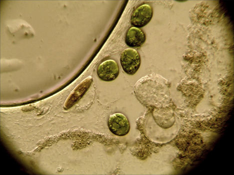 Élő kovamoszat nyugvó állapotú Euglena sejtek között
