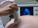 Kismama ultrahang vizsgálaton 