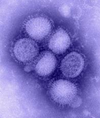 H1N1  mikroszkópos képe