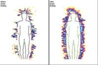 Az emberi energiarendszer (aura) a pránakezelés előtt és után