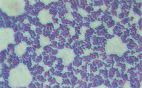 Staphylococcus aureus baktérium