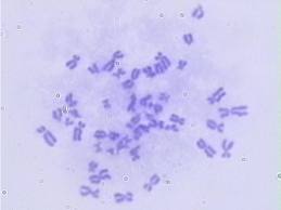 Humán kromoszóma