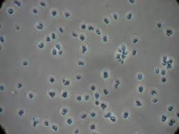 Mikrococcus bactériumuk