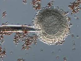 Aspergillus niger gomba mikroszkópos képe