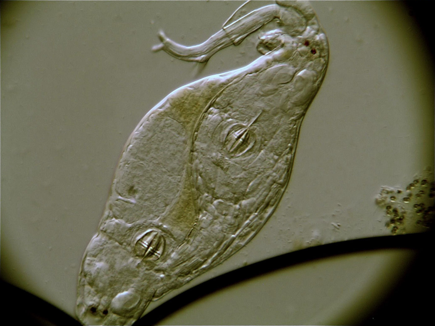 Emberi férgek kepek - Giardia duodenum histopathology