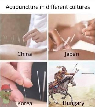 Akupunktúra !