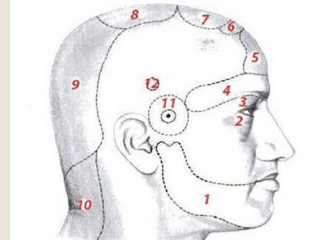A fejfájás okai - az ábrán látható számok azt mutatják, hol jelentkezik leggyakrabban a fejfájás