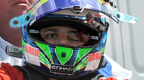 Massa a baleset után!!2009.hungary.
