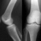 Kétirányú röntgen felvétel