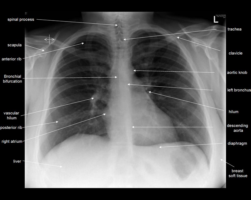 röntgensugárzás alakul ki új látomás öntvényben