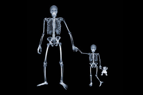 röntgen fotó - apa és fia