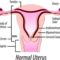 Az uterus