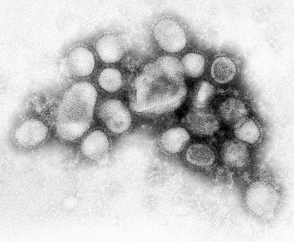 H1N1 Vírus 3
