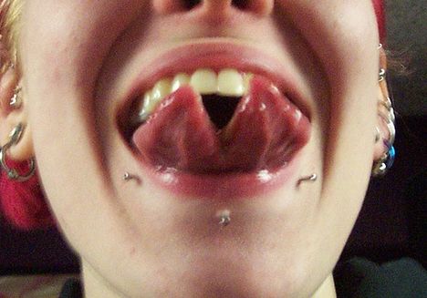 tongue split