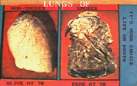 Tüdö  lung comparison