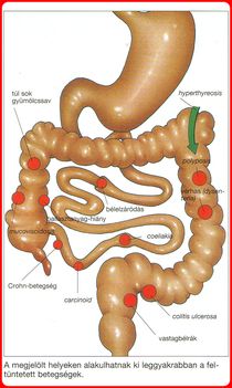 Emésztési zavarok. 2. 3