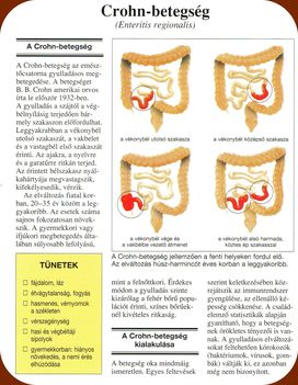 Nyombél fekély és a Crohn betegség. 6