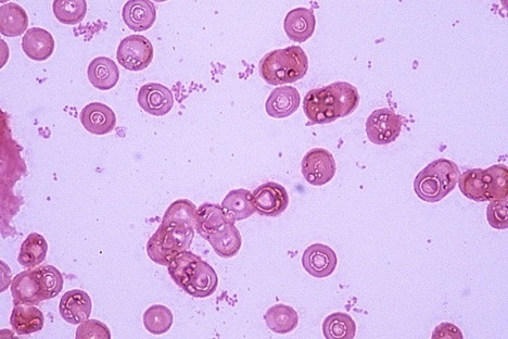 Haemophilus_influenzae