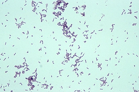 Listeria_monocytogenes