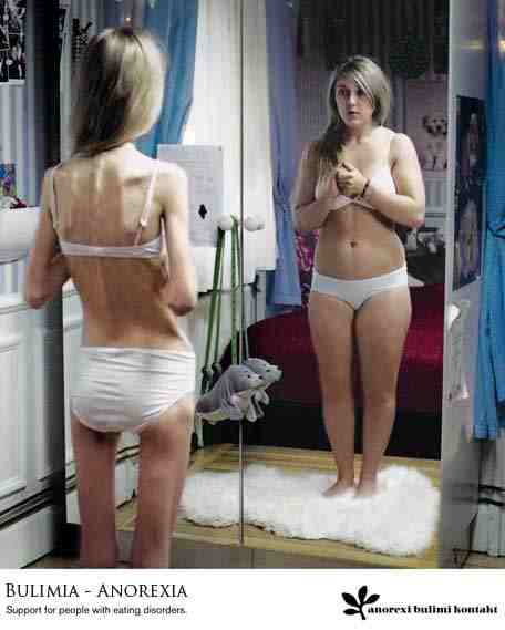 fogyás anorexiás arány)