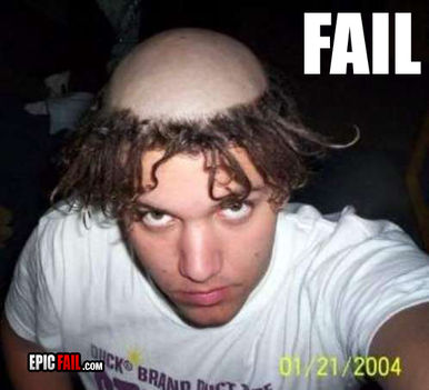 epic-fail-epic-hairstyle-fail-bald-scalp-dreds