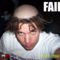 epic-fail-epic-hairstyle-fail-bald-scalp-dreds