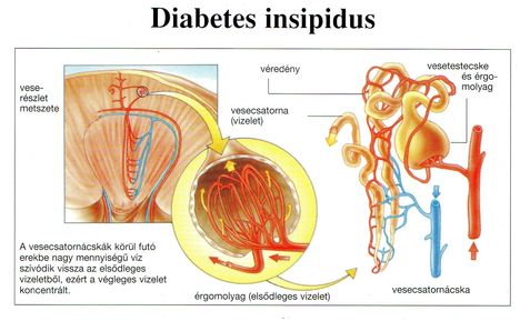 DIABETES INSIPIDUS 2