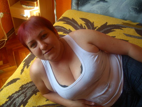 LPIC7441