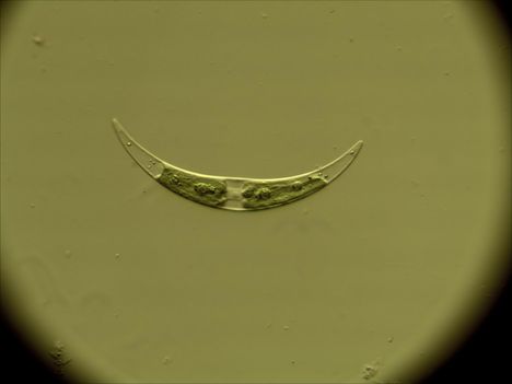 Closterium (Zöldalga faj)