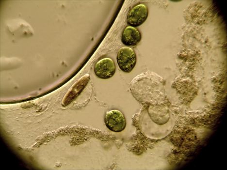 Euglena sejtek,kovamoszat