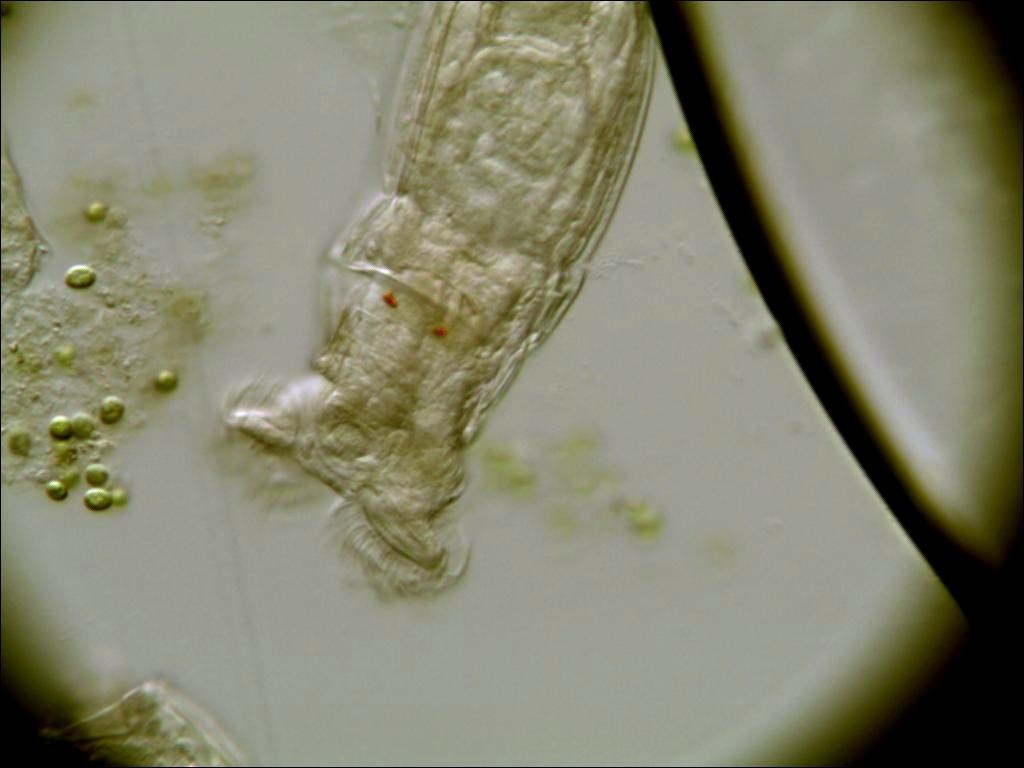 váladék és rossz lehelet a torokban a pinworm betegség életciklusa