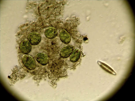 Nyugvó állapotú euglena sejtek