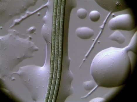 Cyanobaktérium