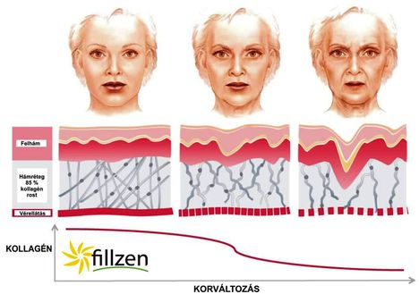 fillzen unilevel 11