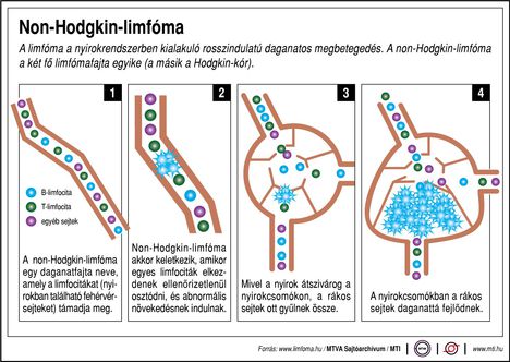 Limfóma