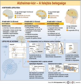 Alzheimer-kór