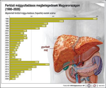 Fertőző májgyulladás