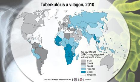 Tuberkulózis