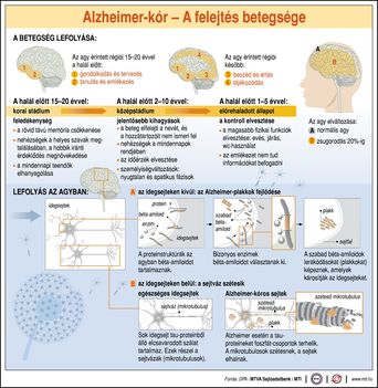 Alzheimer-kór