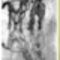 lastscan004
