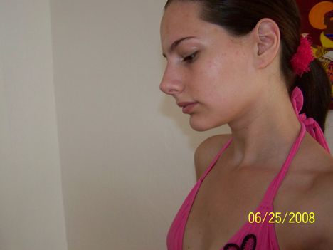 28
