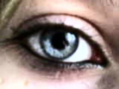 MYeye 