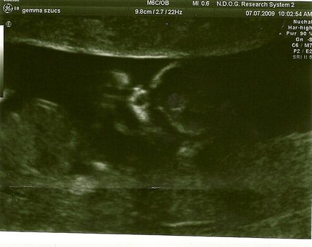 scan0005