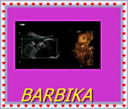 -BARBIKA-