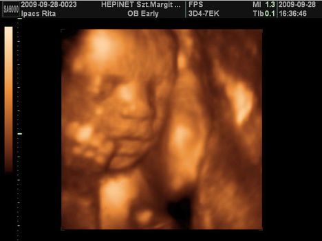 az első unokám, aki januárban fog megszületni