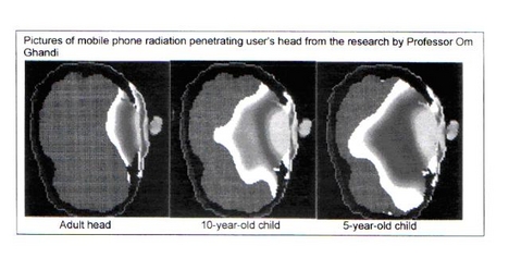 a gyerek és a felnőtt fej besugárzása mobillal