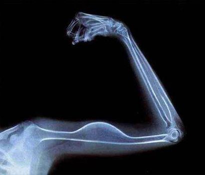 212_xray