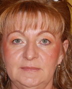 1031613_2325_profile